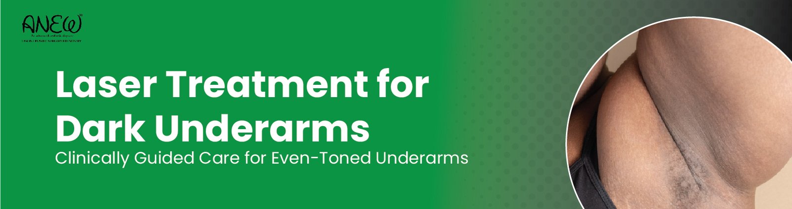  laser treatment for dark underarms